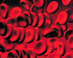 Acumulación de corpos cetonos no sangue na diabetes